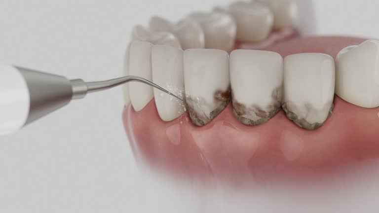 Trusted Teeth Cleaning And Checkup service in Holiday Shores, IL - Dentist Open Now